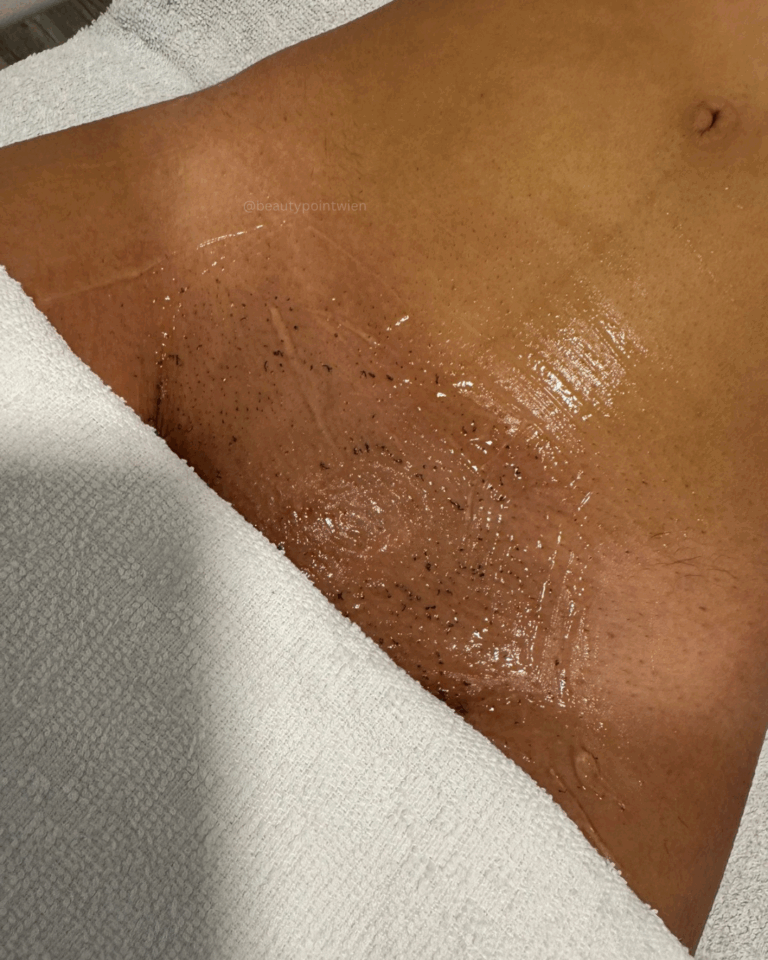 Schwarz Weiß Animiert Dynamisch Vorher Nachher Termin Beauty Instagram Story (Instagram-Post (45)) - 10