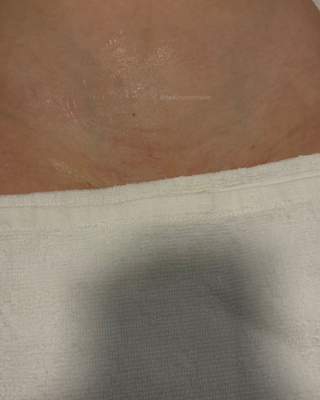 Schwarz Weiß Animiert Dynamisch Vorher Nachher Termin Beauty Instagram Story (Instagram-Post (45)) - 11