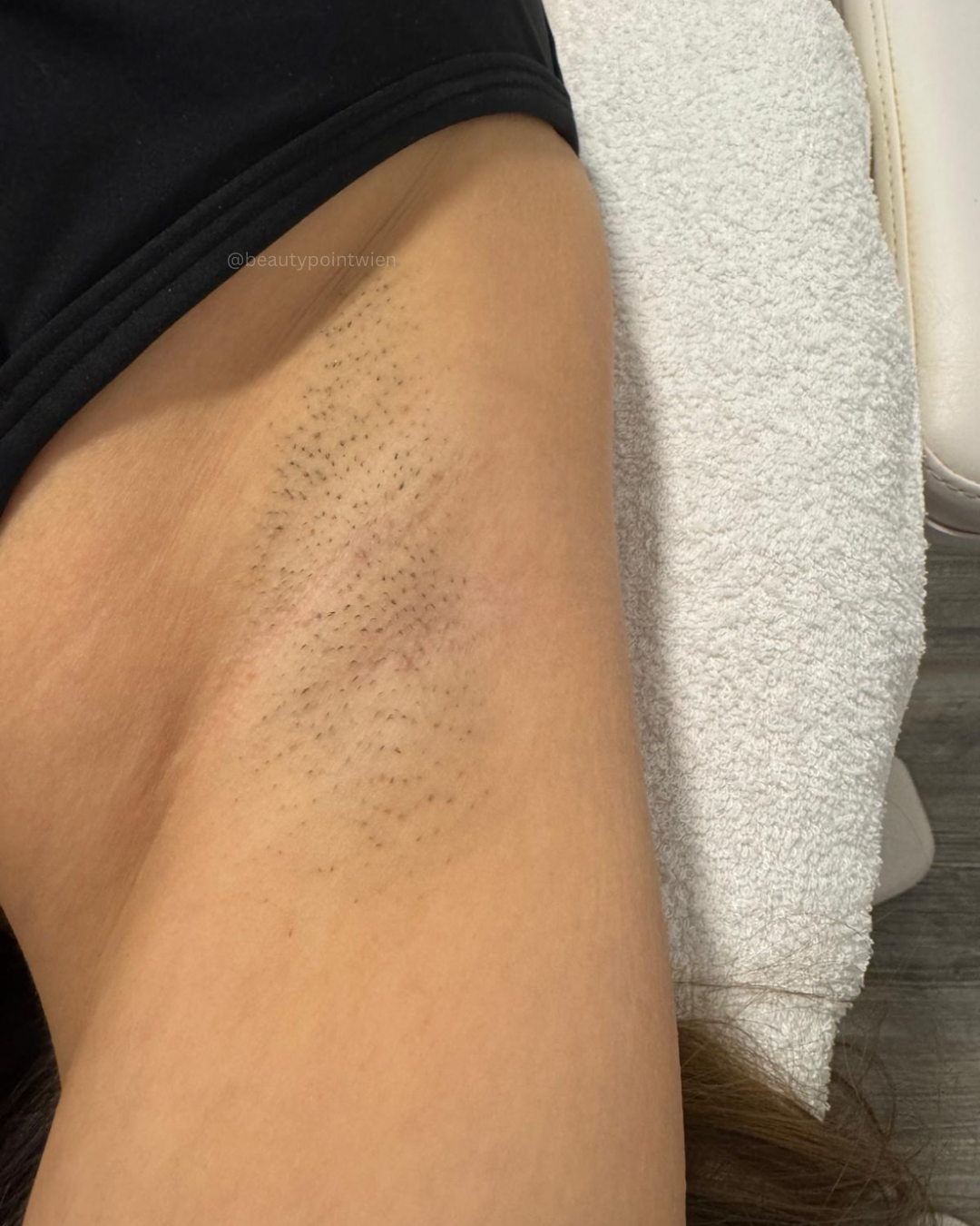 Schwarz Weiß Animiert Dynamisch Vorher Nachher Termin Beauty Instagram Story (Instagram-Post (45)) - 12