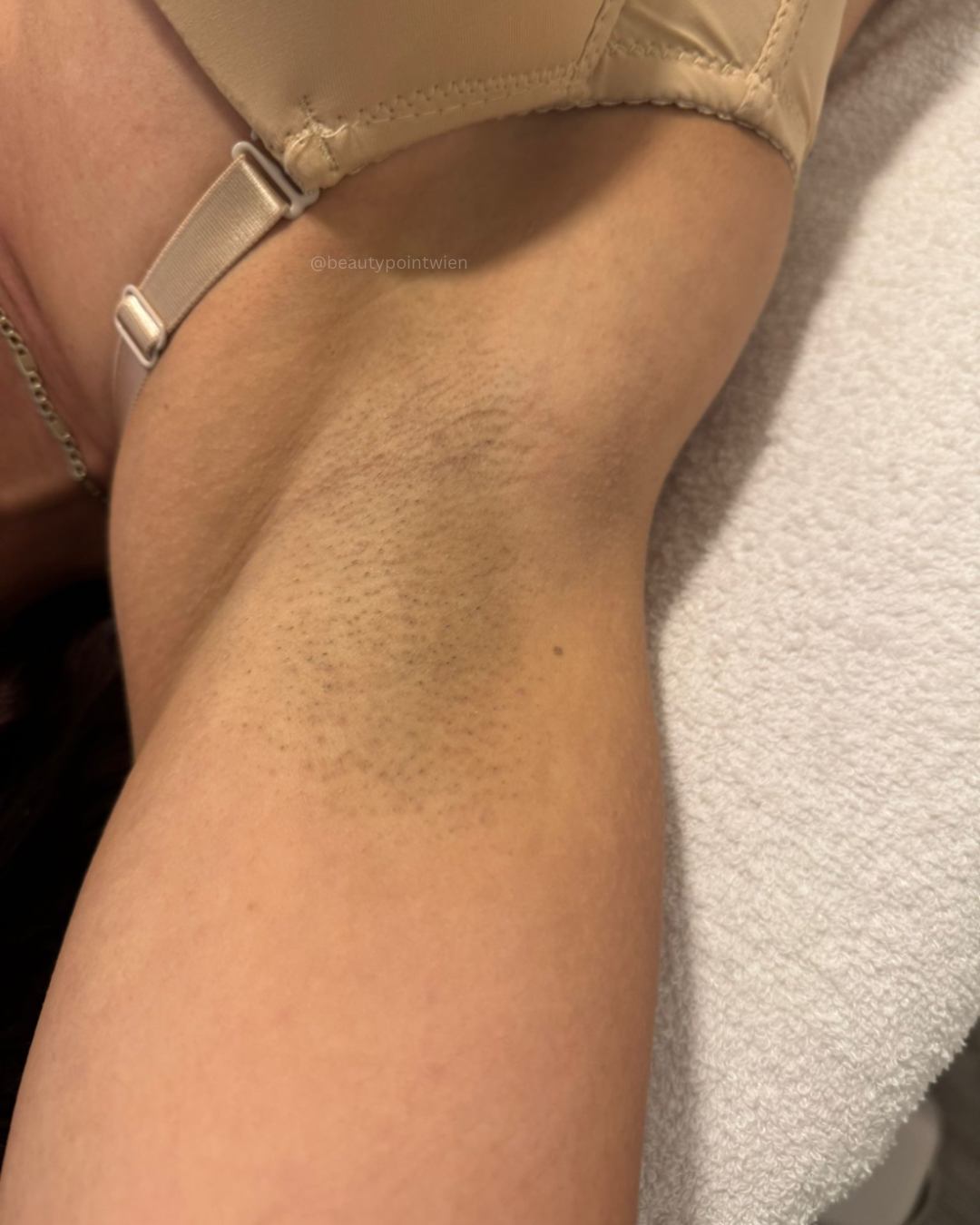 Schwarz Weiß Animiert Dynamisch Vorher Nachher Termin Beauty Instagram Story (Instagram-Post (45)) - 14