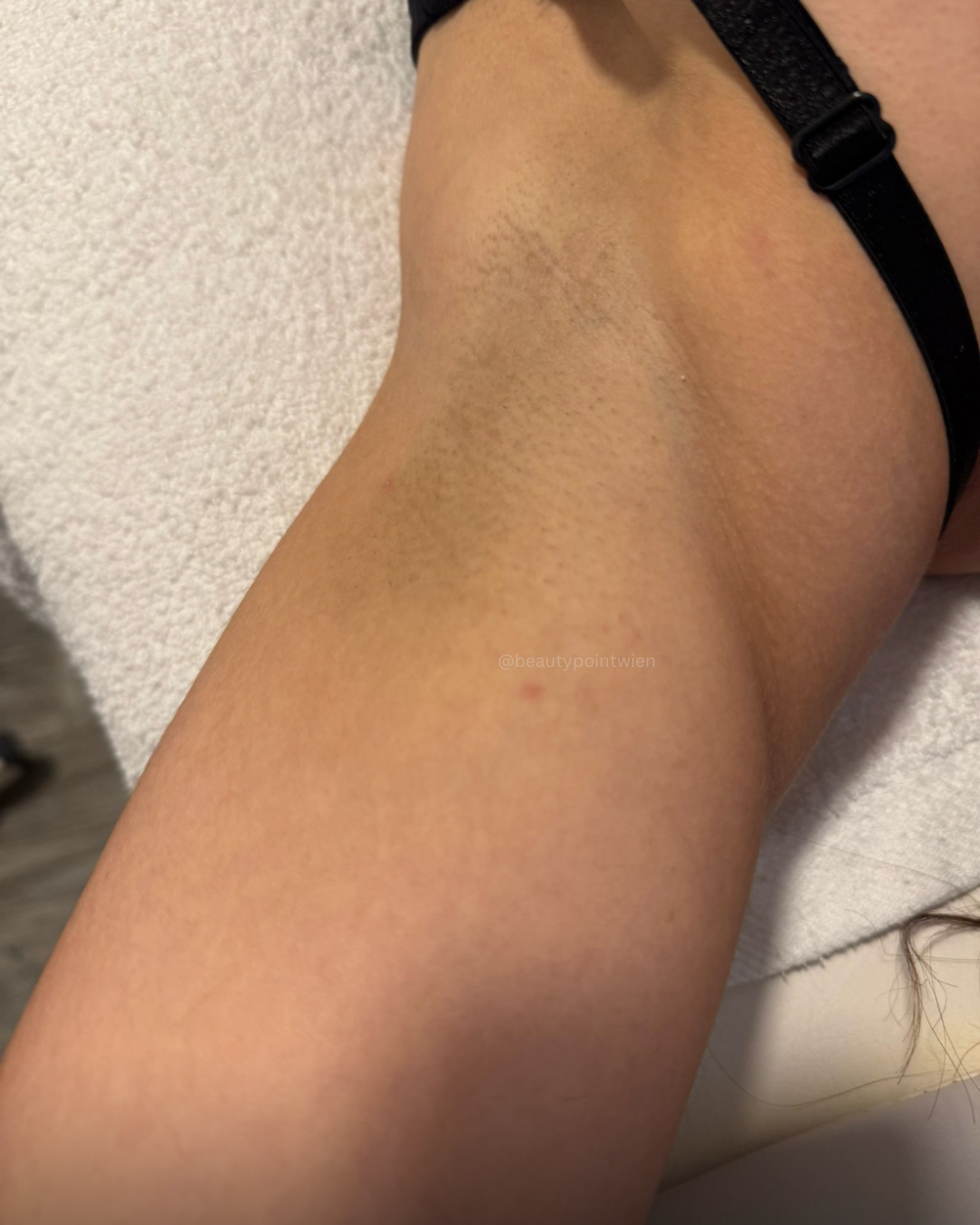 Schwarz Weiß Animiert Dynamisch Vorher Nachher Termin Beauty Instagram Story (Instagram-Post (45)) - 15