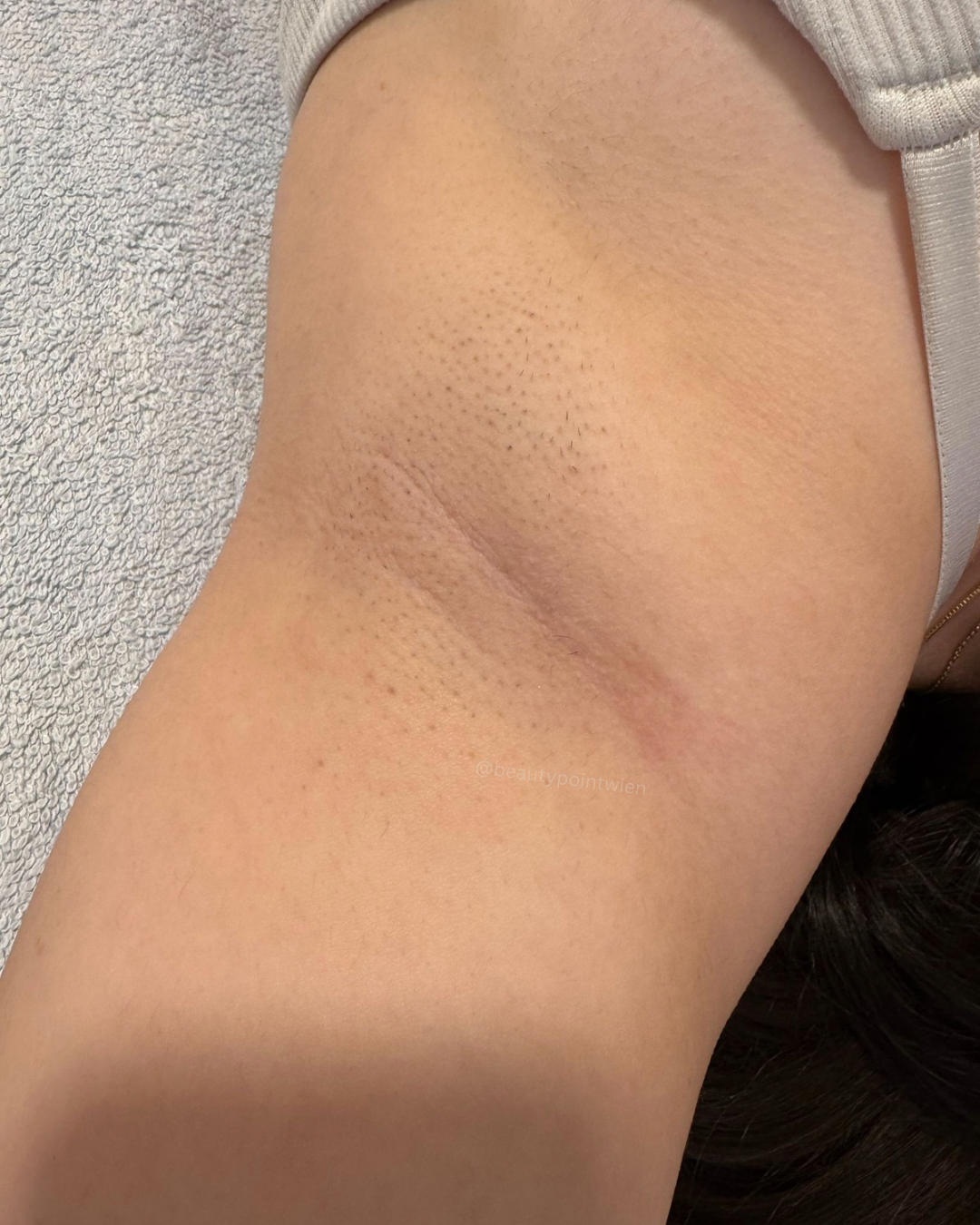 Schwarz Weiß Animiert Dynamisch Vorher Nachher Termin Beauty Instagram Story (Instagram-Post (45)) - 5