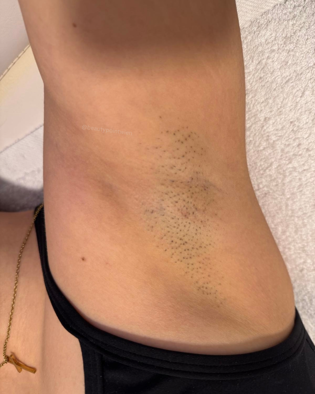 Schwarz Weiß Animiert Dynamisch Vorher Nachher Termin Beauty Instagram Story (Instagram-Post (45)) - 6