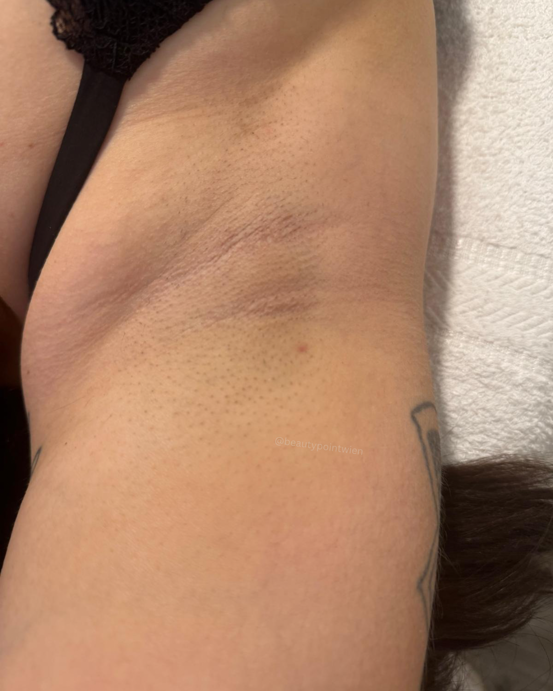 Schwarz Weiß Animiert Dynamisch Vorher Nachher Termin Beauty Instagram Story (Instagram-Post (45)) - 7