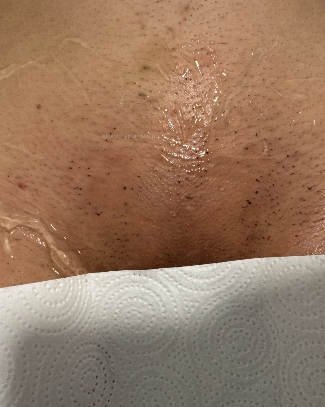 Schwarz Weiß Animiert Dynamisch Vorher Nachher Termin Beauty Instagram Story (Instagram-Post (45)) - 8