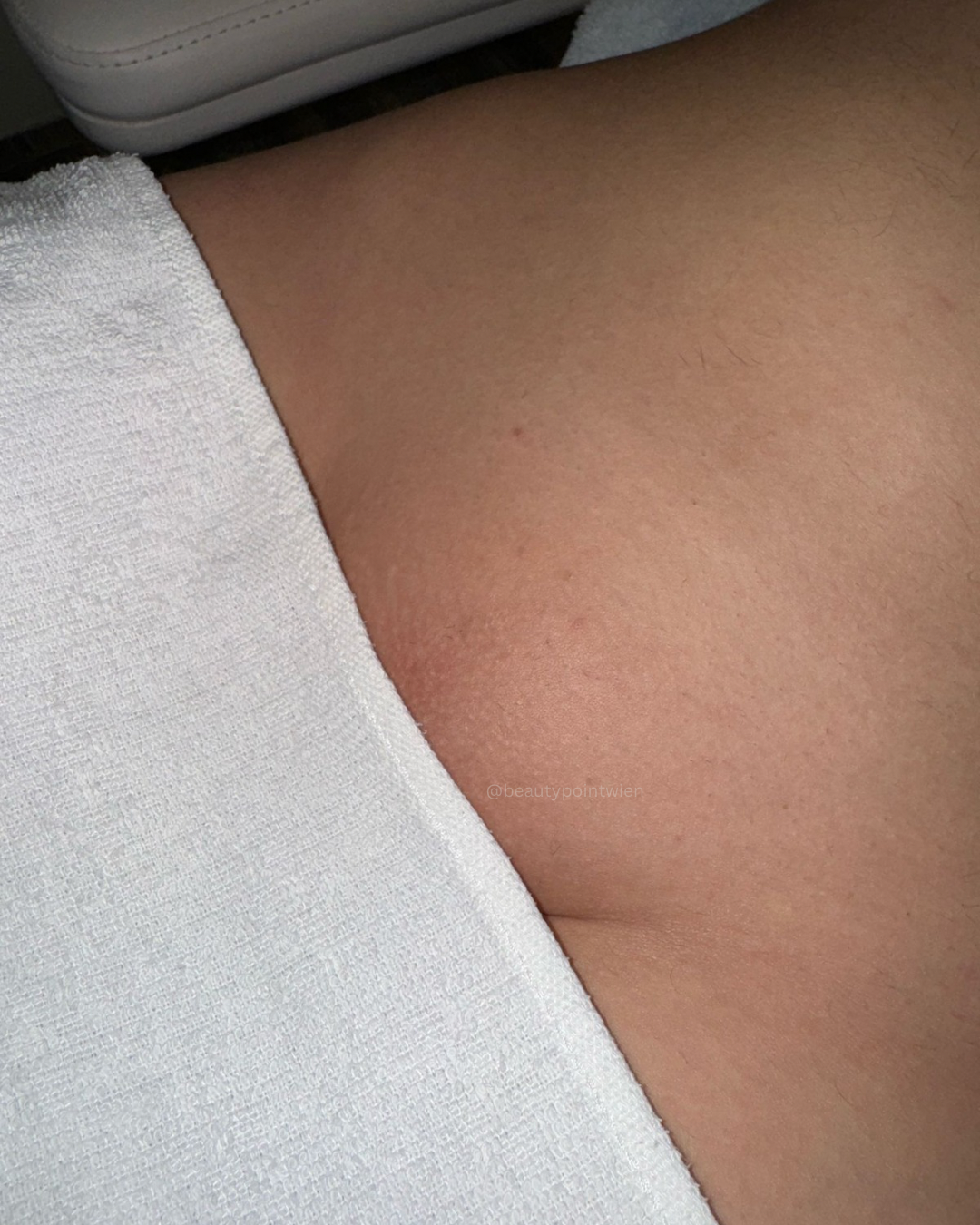 Schwarz Weiß Animiert Dynamisch Vorher Nachher Termin Beauty Instagram Story (Instagram-Post (45)) - 9