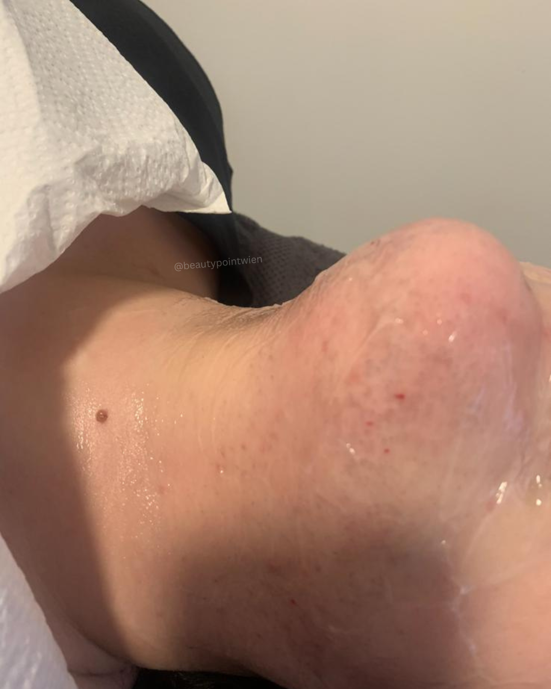 Schwarz Weiß Animiert Dynamisch Vorher Nachher Termin Beauty Instagram Story (Instagram-Post (45)).zip - 2