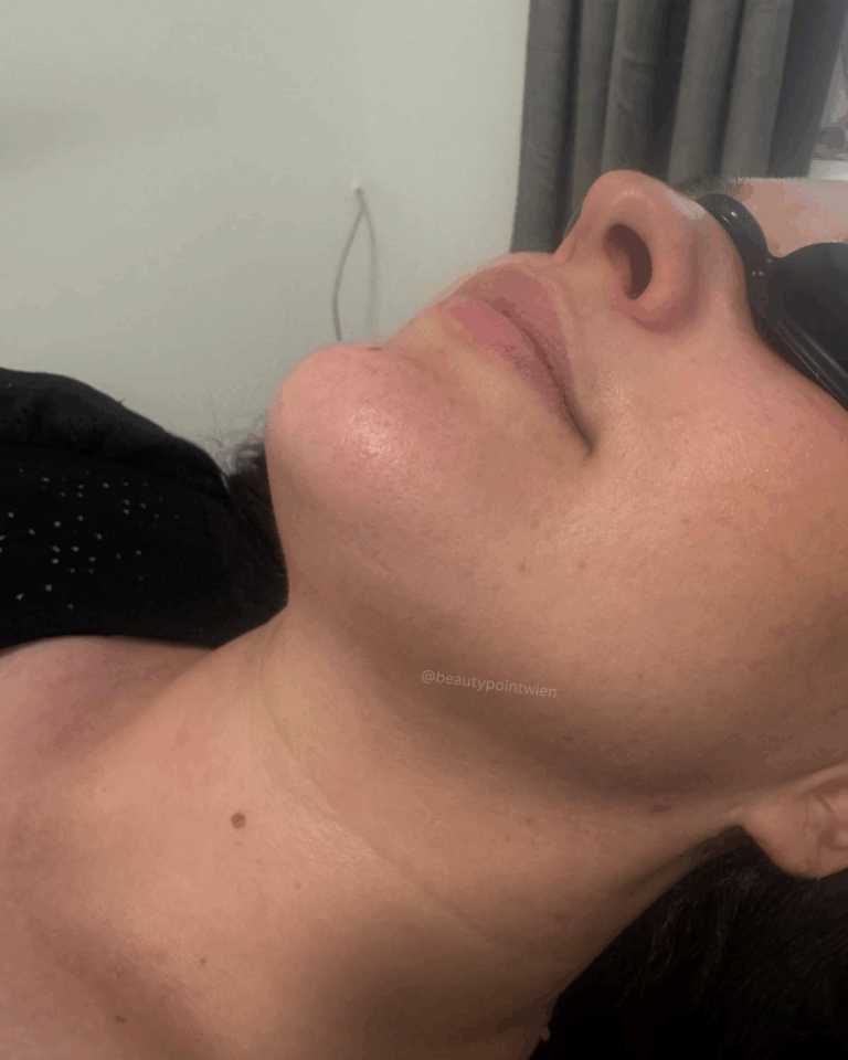 Schwarz Weiß Animiert Dynamisch Vorher Nachher Termin Beauty Instagram Story (Instagram-Post (45)).zip - 3