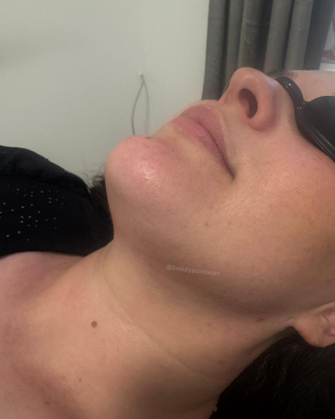 Schwarz Weiß Animiert Dynamisch Vorher Nachher Termin Beauty Instagram Story (Instagram-Post (45)).zip - 3